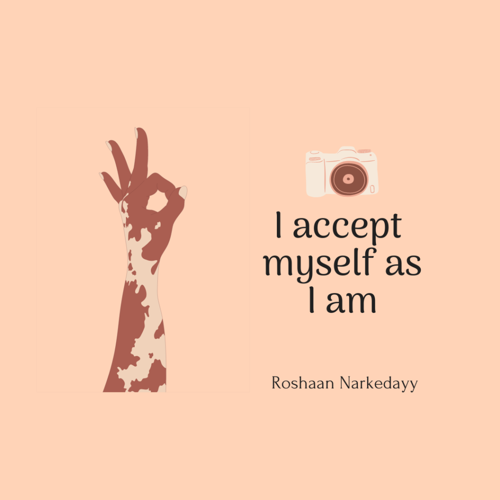 I accept myself as i am - Roshaan narkedayy